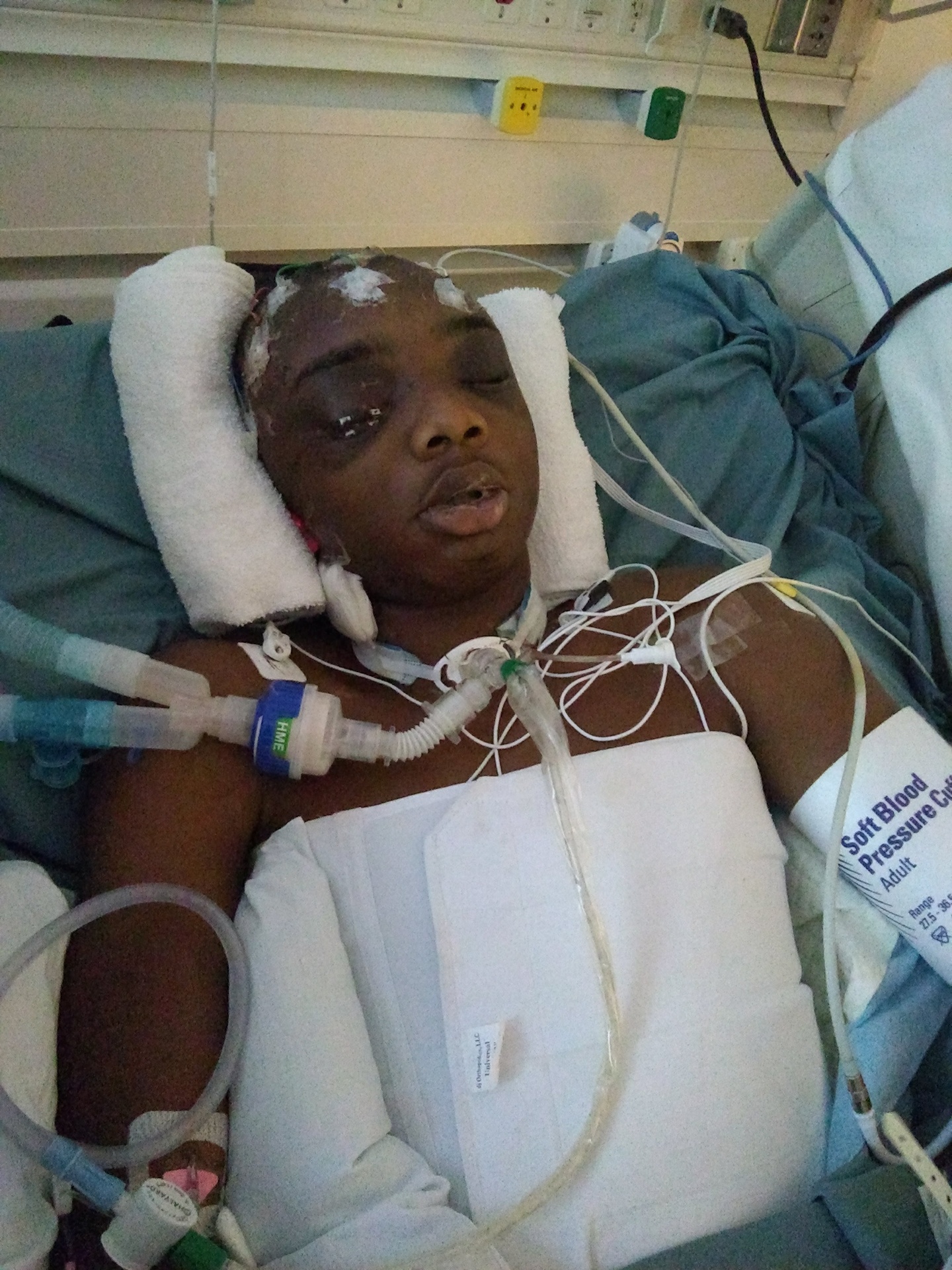 Joseph in hospital after brain surgery