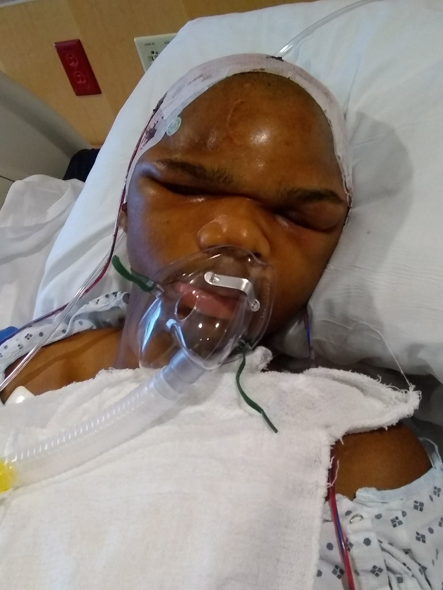 Joseph in critical care after surgery